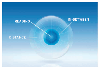 3- Zone Progressive Design